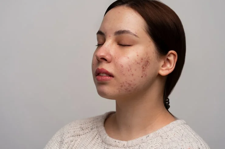 What Sensitive Skin Really Means